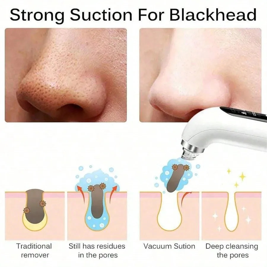 Electric Blackhead Vacuum Remover